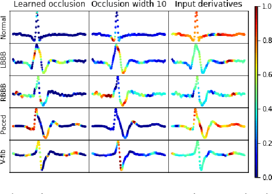 Figure 3 for Techniques for visualizing LSTMs applied to electrocardiograms