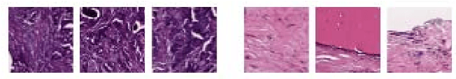 Figure 1 for Multi-Level Batch Normalization In Deep Networks For Invasive Ductal Carcinoma Cell Discrimination In Histopathology Images