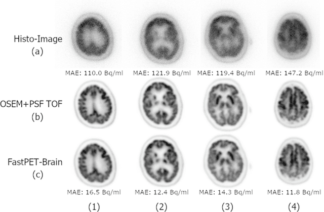 Figure 2 for FastPET: Near Real-Time PET Reconstruction from Histo-Images Using a Neural Network