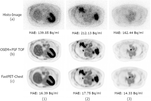 Figure 3 for FastPET: Near Real-Time PET Reconstruction from Histo-Images Using a Neural Network