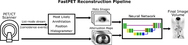 Figure 1 for FastPET: Near Real-Time PET Reconstruction from Histo-Images Using a Neural Network