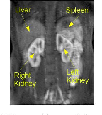 Figure 1 for Functional Segmentation through Dynamic Mode Decomposition: Automatic Quantification of Kidney Function in DCE-MRI Images