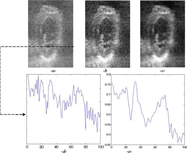 Figure 4 for Speckle Noise Reduction in Medical Ultrasound Images