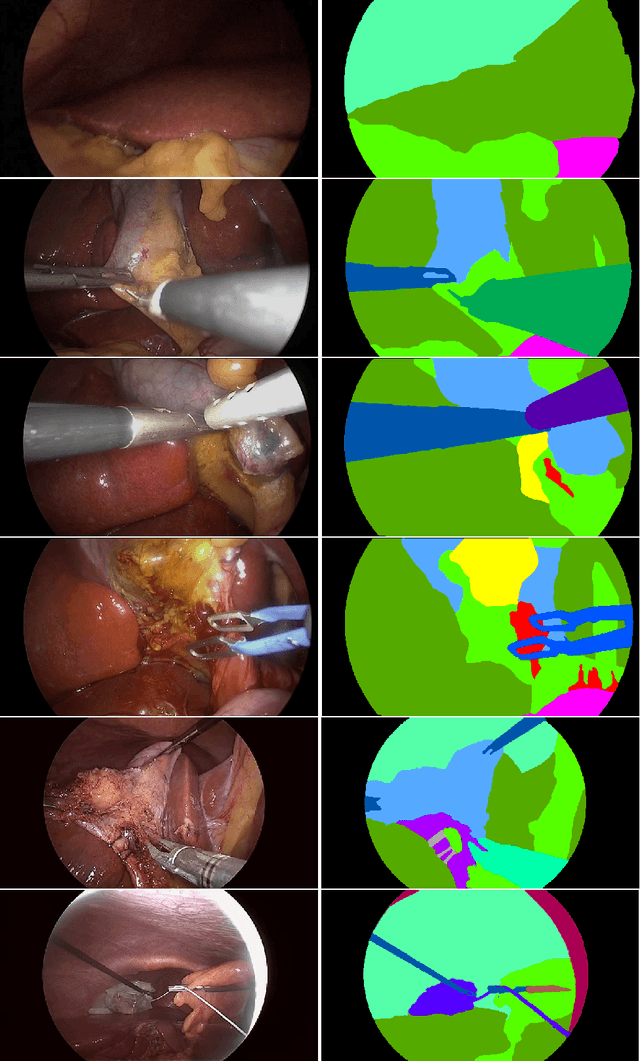 Figure 1 for m2caiSeg: Semantic Segmentation of Laparoscopic Images using Convolutional Neural Networks