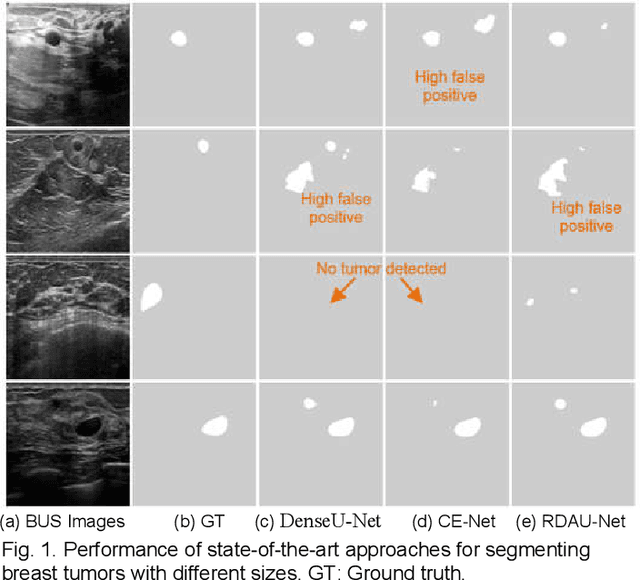 Figure 1 for ESTAN: Enhanced Small Tumor-Aware Network for Breast Ultrasound Image Segmentation