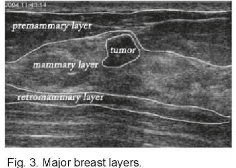 Figure 3 for ESTAN: Enhanced Small Tumor-Aware Network for Breast Ultrasound Image Segmentation