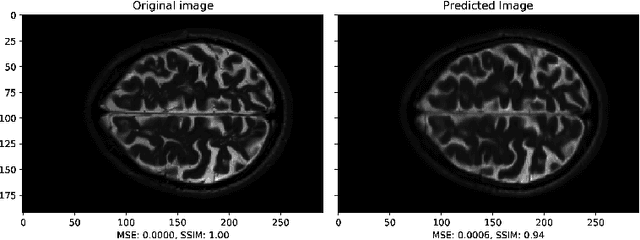 Figure 4 for A Multimodal Deep Network for the Reconstruction of T2W MR Images