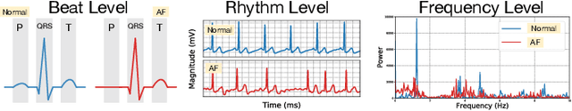 Figure 1 for MINA: Multilevel Knowledge-Guided Attention for Modeling Electrocardiography Signals