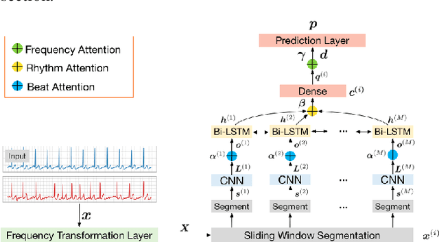 Figure 3 for MINA: Multilevel Knowledge-Guided Attention for Modeling Electrocardiography Signals