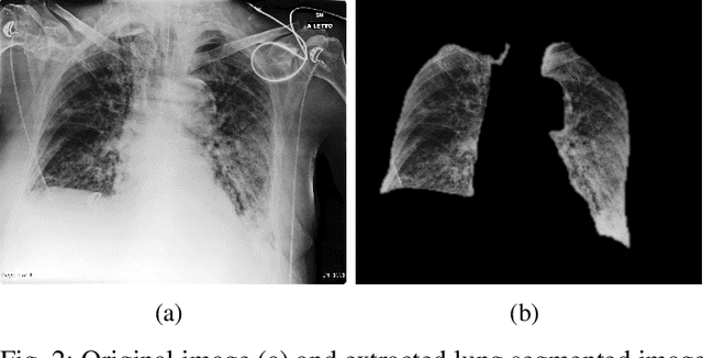 Figure 2 for Unveiling COVID-19 from Chest X-ray with deep learning: a hurdles race with small data