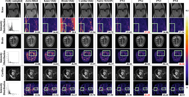Figure 4 for Seeking Common Ground While Reserving Differences: Multiple Anatomy Collaborative Framework for Undersampled MRI Reconstruction