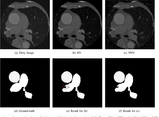 Figure 3 for Do Noises Bother Human and Neural Networks In the Same Way? A Medical Image Analysis Perspective