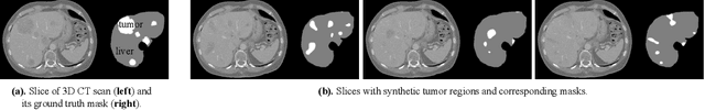 Figure 3 for High Resolution Medical Image Analysis with Spatial Partitioning