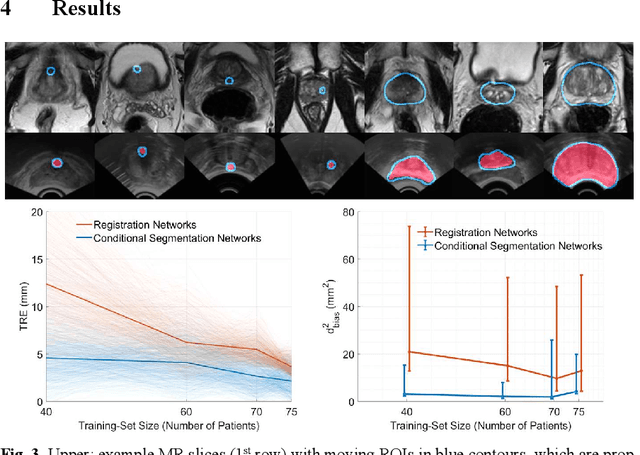 Figure 3 for Conditional Segmentation in Lieu of Image Registration