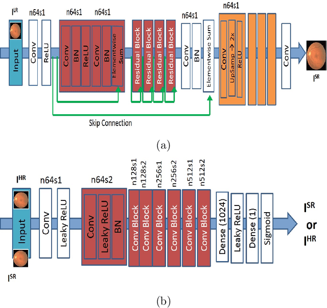 Figure 3 for Progressive Generative Adversarial Networks for Medical Image Super resolution
