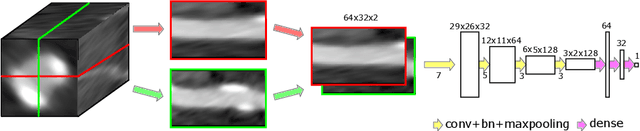 Figure 1 for Deep Learning Algorithms for Coronary Artery Plaque Characterisation from CCTA Scans