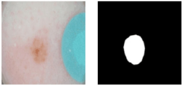 Figure 1 for LesionSeg: Semantic segmentation of skin lesions using Deep Convolutional Neural Network