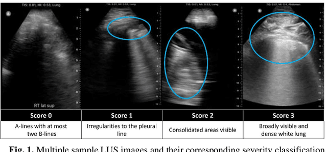Figure 2 for Rapid Lung Ultrasound COVID-19 Severity Scoring with Resource-Efficient Deep Feature Extraction