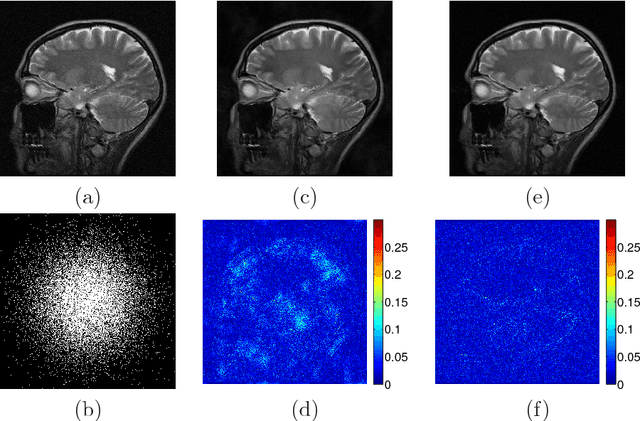 Figure 4 for Efficient Blind Compressed Sensing Using Sparsifying Transforms with Convergence Guarantees and Application to MRI