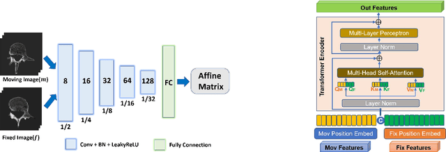 Figure 2 for ACSGRegNet: A Deep Learning-based Framework for Unsupervised Joint Affine and Diffeomorphic Registration of Lumbar Spine CT via Cross- and Self-Attention Fusion