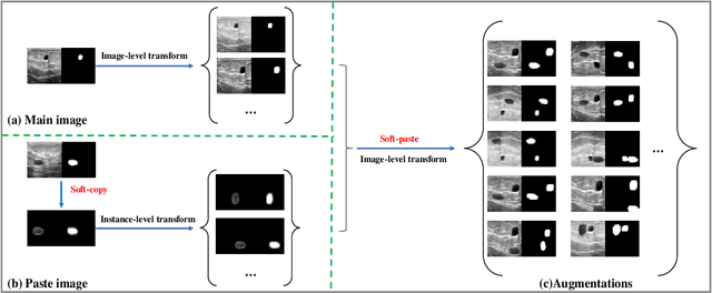 Figure 2 for Soft-CP: A Credible and Effective Data Augmentation for Semantic Segmentation of Medical Lesions