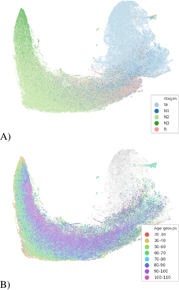 Figure 4 for Self-supervised representation learning from electroencephalography signals