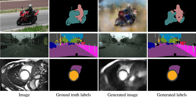 Figure 3 for Revisiting CycleGAN for semi-supervised segmentation