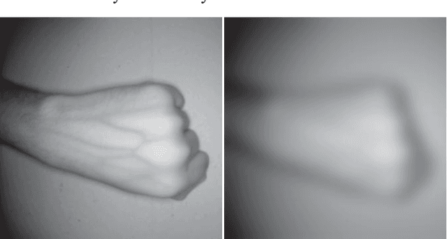 Figure 1 for Super-Efficient Spatially Adaptive Contrast Enhancement Algorithm for Superficial Vein Imaging