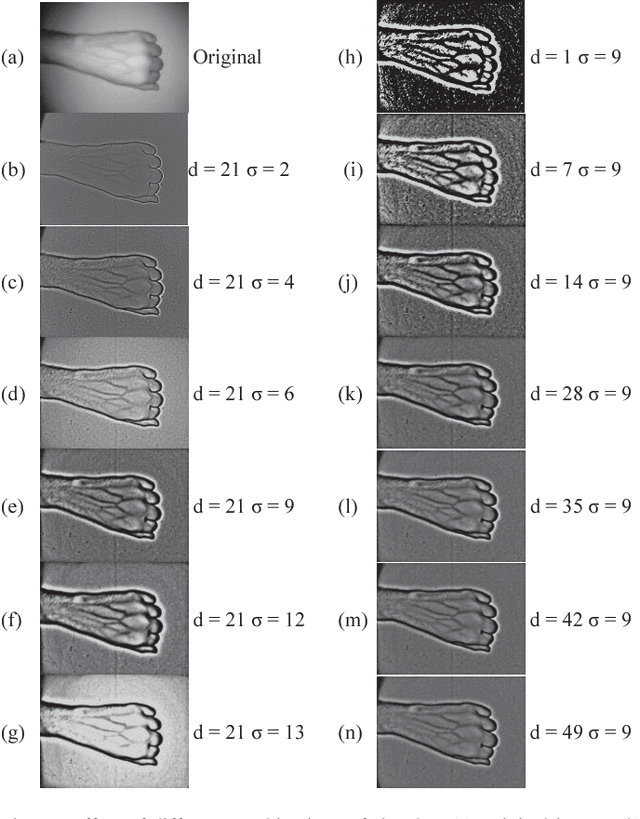 Figure 3 for Super-Efficient Spatially Adaptive Contrast Enhancement Algorithm for Superficial Vein Imaging