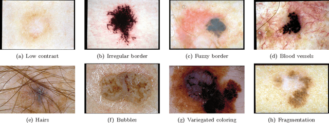 Figure 1 for Lesion Border Detection in Dermoscopy Images