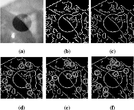 Figure 4 for ElSe: Ellipse Selection for Robust Pupil Detection in Real-World Environments