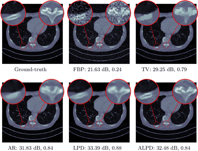 Figure 3 for Adversarially learned iterative reconstruction for imaging inverse problems