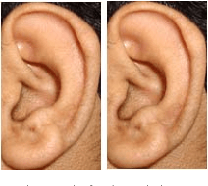 Figure 1 for SIFT-based Ear Recognition by Fusion of Detected Keypoints from Color Similarity Slice Regions