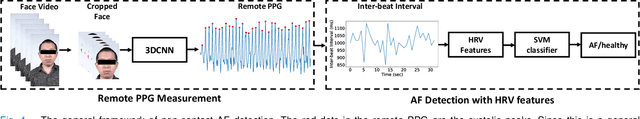 Figure 1 for Non-contact Atrial Fibrillation Detection from Face Videos by Learning Systolic Peaks