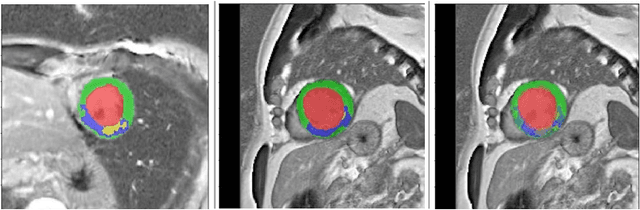 Figure 1 for Anatomy Prior Based U-net for Pathology Segmentation with Attention