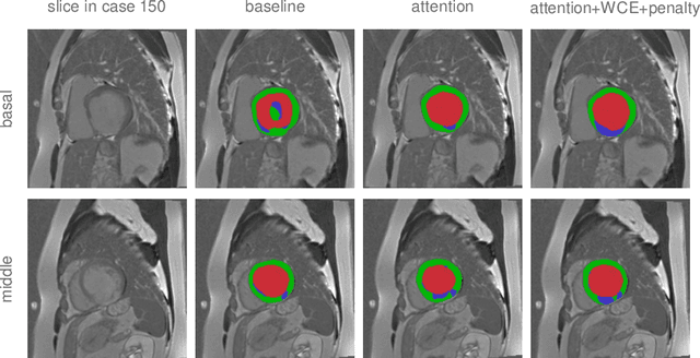 Figure 4 for Anatomy Prior Based U-net for Pathology Segmentation with Attention