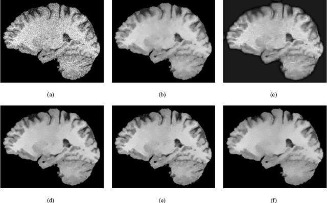 Figure 2 for A New Similarity Measure for Non-Local Means Filtering of MRI Images