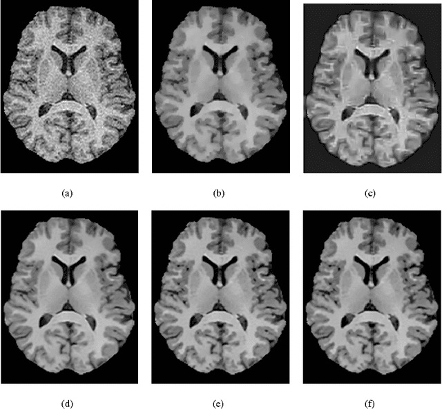 Figure 3 for A New Similarity Measure for Non-Local Means Filtering of MRI Images