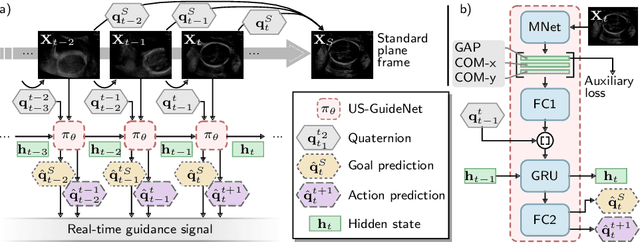Figure 2 for Automatic Probe Movement Guidance for Freehand Obstetric Ultrasound