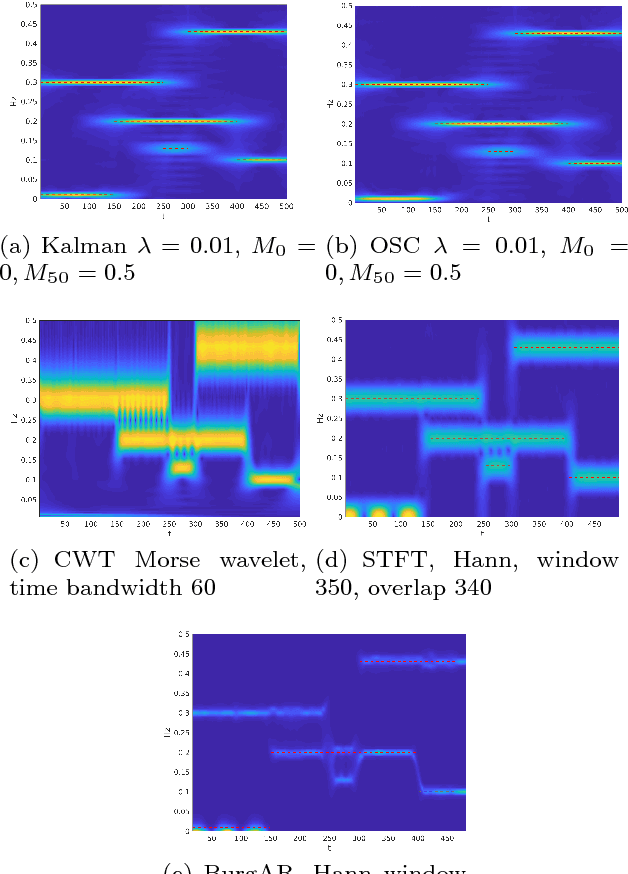 Figure 3 for Kalman-based Spectro-Temporal ECG Analysis using Deep Convolutional Networks for Atrial Fibrillation Detection
