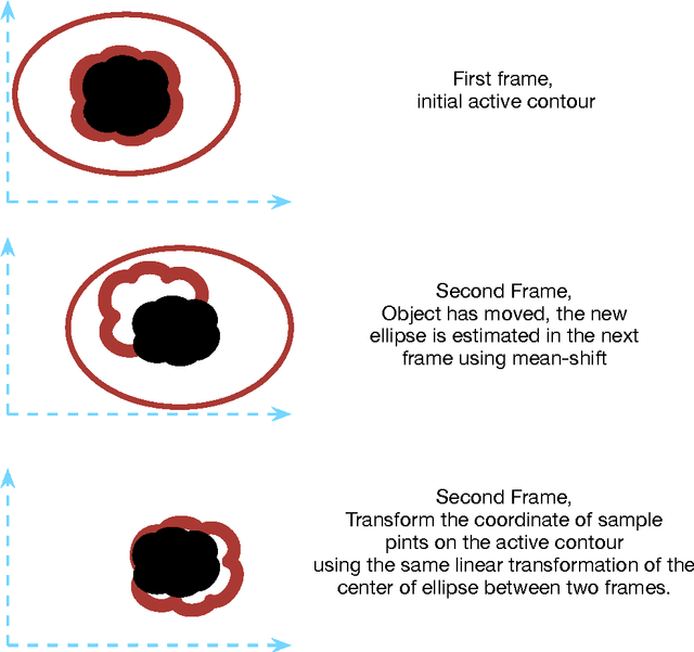 Figure 1 for Tumor Motion Tracking in Liver Ultrasound Images Using Mean Shift and Active Contour