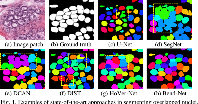Figure 1 for Bend-Net: Bending Loss Regularized Multitask Learning Network for Nuclei Segmentation in Histopathology Images