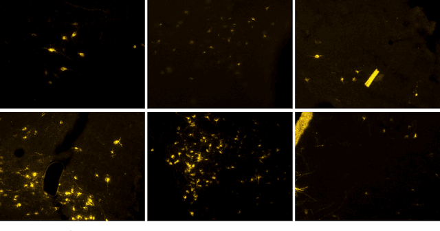 Figure 1 for Automatic Cell Counting in Flourescent Microscopy Using Deep Learning