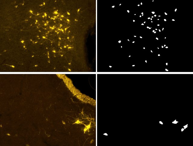 Figure 2 for Automatic Cell Counting in Flourescent Microscopy Using Deep Learning