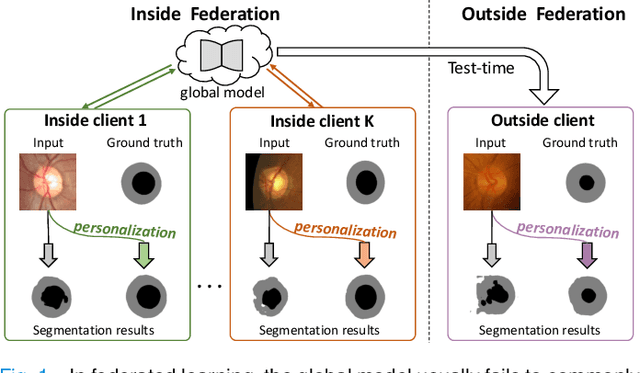 Figure 1 for IOP-FL: Inside-Outside Personalization for Federated Medical Image Segmentation