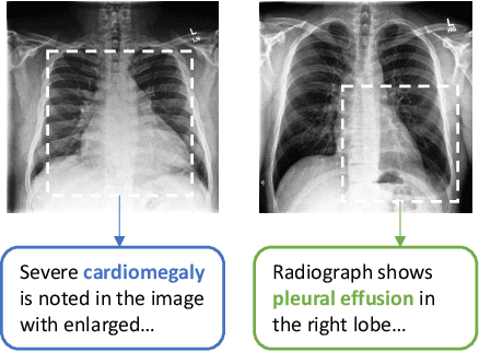 Figure 1 for Contrastive Learning of Medical Visual Representations from Paired Images and Text