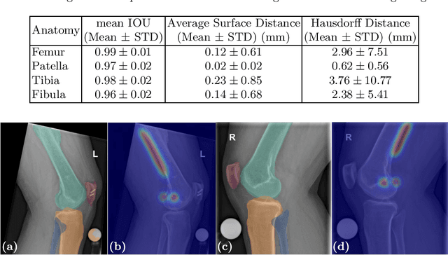 Figure 2 for Multi-task Localization and Segmentation for X-ray Guided Planning in Knee Surgery