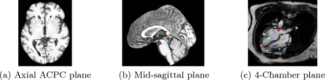 Figure 3 for Automatic View Planning with Multi-scale Deep Reinforcement Learning Agents