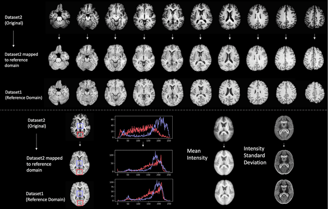 Figure 1 for Medical Image Harmonization Using Deep Learning Based Canonical Mapping: Toward Robust and Generalizable Learning in Imaging
