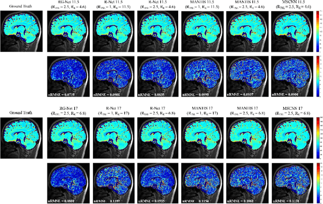 Figure 4 for Highly accelerated MR parametric mapping by undersampling the k-space and reducing the contrast number simultaneously with deep learning